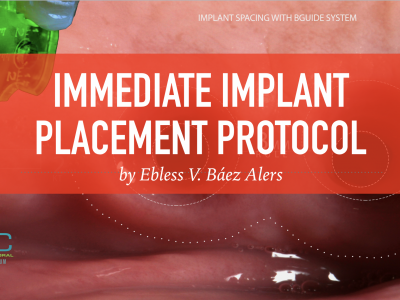 IMMEDIATE IMPLANT PLACEMENT PROTOCOL
